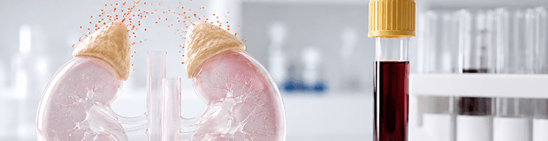 Servicio de test de cortisol en sangre
