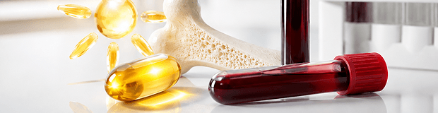 Servicio de test de vitamina D